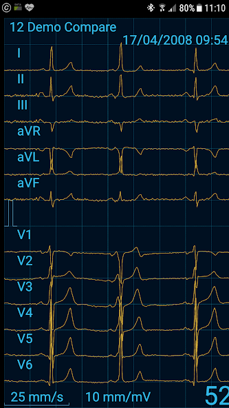 Cardiax Mobile ECG