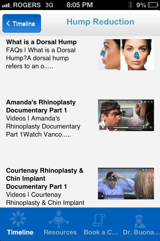 MyRhinoplasty