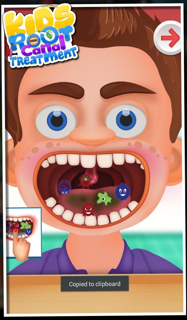 Root Canal Treatment