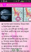 Breast Screening
